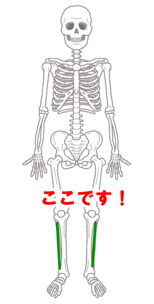 body_kokkaku_gaikotsu21.png